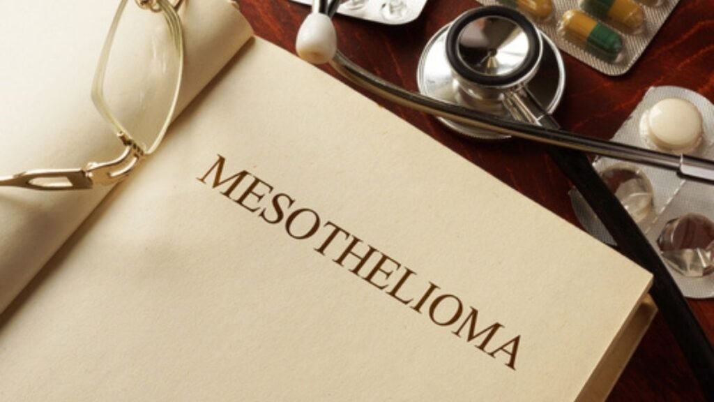 Mesothelioma Stages – Know the Different Staging Systems